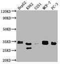 Western Blot
Positive WB detected in: HepG2 whole cell lysate, K562 whole cell lysate, U251 whole cell lysate, MCF-7 whole cell lysate, PC-3 whole cell lysate
All lanes: RPIA antibody at 1:2000
Secondary
Goat polyclonal to rabbit IgG at 1/50000 dilution
Predicted band size: 34 kDa
Observed band size: 33 kDa