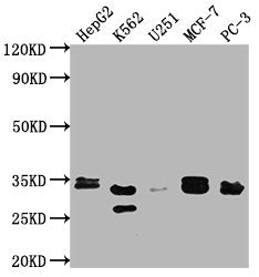 Western Blot
Positive WB detected in: HepG2 whole cell lysate, K562 whole cell lysate, U251 whole cell lysate, MCF-7 whole cell lysate, PC-3 whole cell lysate
All lanes: RPIA antibody at 1:2000
Secondary
Goat polyclonal to rabbit IgG at 1/50000 dilution
Predicted band size: 34 kDa
Observed band size: 33 kDa