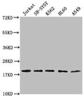 Western Blot
Positive WB detected in: Jurkat whole cell lysate, SH-SY5Y whole cell lysate, K562 whole cell lysate, HL-60 whole cell lysate, A549 whole cell lysate
All lanes: RPL24 antibody at 1:2000
Secondary
Goat polyclonal to rabbit IgG at 1/50000 dilution
Predicted band size: 18 kDa
Observed band size: 18 kDa