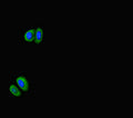 RPS6KB1 Antibody – Figure 1 of 2