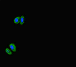 RPS6KB1 Antibody – Figure 1 of 2