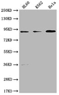 Western Blot
Positive WB detected in: HL60 whole cell lysate, K562 whole cell lysate, Hela whole cell lysate
All lanes: RPTN antibody at 1:1000
Secondary
Goat polyclonal to rabbit IgG at 1/50000 dilution
Predicted band size: 91 kDa
Observed band size: 91 kDa