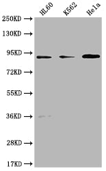 Western Blot
Positive WB detected in: HL60 whole cell lysate, K562 whole cell lysate, Hela whole cell lysate
All lanes: RPTN antibody at 1:1000
Secondary
Goat polyclonal to rabbit IgG at 1/50000 dilution
Predicted band size: 91 kDa
Observed band size: 91 kDa