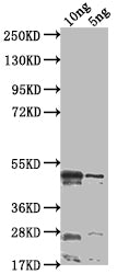 Western Blot
Positive WB detected in Recombinant protein
All lanes: rsad2 antibody at 1:2000
Secondary
Goat polyclonal to rabbit IgG at 1/50000 dilution
Predicted band size: 44.1 kDa
Observed band size: 44 kDa