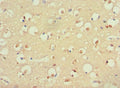 Immunohistochemistry of paraffin-embedded human brain tissue using CSB-PA020643ESR1HU at dilution of 1:100