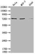 Western Blot
Positive WB detected in: Hela whole cell lysate, MCF-7 whole cell lysate, A549 whole cell lysate
All lanes: SAMHD1 antibody at 1:2000
Secondary
Goat polyclonal to rabbit IgG at 1/50000 dilution
Predicted band size: 73, 64, 69 kDa
Observed band size: 73 kDa