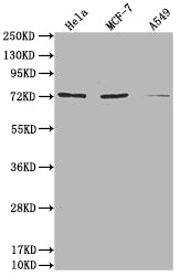 Western Blot
Positive WB detected in: Hela whole cell lysate, MCF-7 whole cell lysate, A549 whole cell lysate
All lanes: SAMHD1 antibody at 1:2000
Secondary
Goat polyclonal to rabbit IgG at 1/50000 dilution
Predicted band size: 73, 64, 69 kDa
Observed band size: 73 kDa