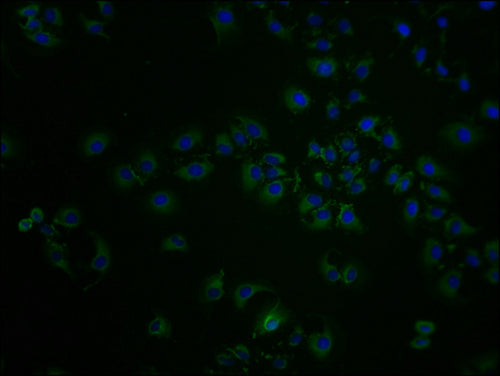 Immunofluorescence staining of A549 cells with CSB-PA020850LA01HU at 1:100, counter-stained with DAPI. The cells were fixed in 4% formaldehyde and blocked in 10% normal Goat Serum. The cells were then incubated with the antibody overnight at 4°C. The secondary antibody was Alexa Fluor 488-congugated AffiniPure Goat Anti-Rabbit IgG(H+L).