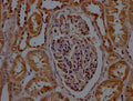 IHC image of CSB-PA020907LA01HU diluted at 1:200 and staining in paraffin-embedded human kidney tissue performed on a Leica BondTM system. After dewaxing and hydration, antigen retrieval was mediated by high pressure in a citrate buffer (pH 6.0). Section was blocked with 10% normal goat serum 30min at RT. Then primary antibody (1% BSA) was incubated at 4°C overnight. The primary is detected by a Goat anti-rabbit polymer IgG labeled by HRP and visualized using 0.05% DAB.