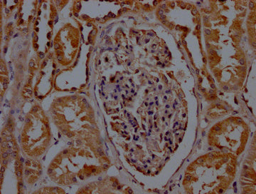 IHC image of CSB-PA020907LA01HU diluted at 1:200 and staining in paraffin-embedded human kidney tissue performed on a Leica BondTM system. After dewaxing and hydration, antigen retrieval was mediated by high pressure in a citrate buffer (pH 6.0). Section was blocked with 10% normal goat serum 30min at RT. Then primary antibody (1% BSA) was incubated at 4°C overnight. The primary is detected by a Goat anti-rabbit polymer IgG labeled by HRP and visualized using 0.05% DAB.
