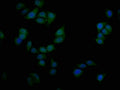 Immunofluorescence staining of Hela cells with CSB-PA021325LA01HU at 1:50, counter-stained with DAPI. The cells were fixed in 4% formaldehyde and blocked in 10% normal Goat Serum. The cells were then incubated with the antibody overnight at 4°C. The secondary antibody was Alexa Fluor 488-congugated AffiniPure Goat Anti-Rabbit IgG(H+L).
