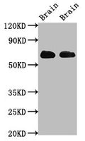 Western Blot
Positive WB detected in: Rat brain tissue, Mouse brain tissue
All lanes: SLC1A2 antibody at 3.2ug/ml
Secondary
Goat polyclonal to rabbit IgG at 1/50000 dilution
Predicted band size: 63, 62 kDa
Observed band size: 63 kDa