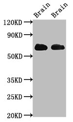 Western Blot
Positive WB detected in: Rat brain tissue, Mouse brain tissue
All lanes: SLC1A2 antibody at 3.2ug/ml
Secondary
Goat polyclonal to rabbit IgG at 1/50000 dilution
Predicted band size: 63, 62 kDa
Observed band size: 63 kDa