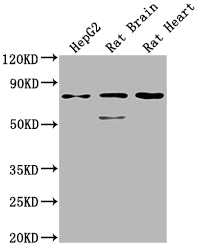 Western Blot
Positive WB detected in: HepG2 whole cell lysate, Rat Brain tissue, Rat Heart tissue
All lanes: SLC1A7 antibody at 1:2000
Secondary
Goat polyclonal to rabbit IgG at 1/50000 dilution
Predicted band size: 61, 18 kDa
Observed band size: 75 kDa