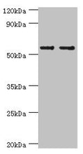 Western blot
All lanes: SLC2A1 antibody at 6µg/ml
Lane 1: NIH/3T3 whole cell lysate
Lane 2: Hela whole cell lysate
Secondary
Goat polyclonal to rabbit IgG&nbsp;at 1/10000 dilution
Predicted band size: 54 kDa
Observed band size: 54 kDa
