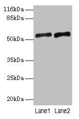 SLC2A4 Antibody, HRP conjugated – Figure 1 of 4