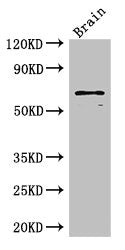 Western Blot
Positive WB detected in: Mouse brain tissue
All lanes: SLC6A3 antibody at 3ug/ml
Secondary
Goat polyclonal to rabbit IgG at 1/50000 dilution
Predicted band size: 69 kDa
Observed band size: 69 kDa