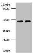 Western blot All lanes: SMAD3 antibody at 8ug/ml Lane 1: Jurkat whole cell lysate Lane 2: A431 whole cell lysate Secondary Goat polyclonal to rabbit IgG at 1/10000 dilution Predicted band size: 49, 44, 36, 26 kDa Observed band size: 49 kDa