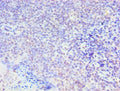 Immunohistochemistry of paraffin-embedded human tonsil tissue using CSB-PA021794ESR1HU at dilution of 1:100