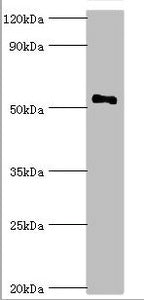 Western blot
All lanes: Mothers against decapentaplegic homolog 9 antibody at 2ug/ml + 293T whole cell lysate
Secondary
Goat polyclonal to rabbit IgG at 1/10000 dilution
Predicted band size: 53, 49 kDa
Observed band size: 53 kDa