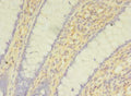 SNAI1 Antibody, HRP conjugated – Figure 1 of 1