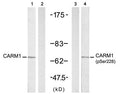 Western blot analysis of extracts from A431 cells untreated or treated with EGF(200ng/ml, 5min), using CARM1(Ab-228) antibody(, Line 1 and 2) and CARM1(Phospho-Ser228) antibody(, Line 3 and 4).