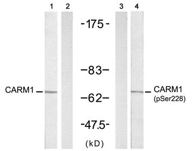 Western blot analysis of extracts from A431 cells untreated or treated with EGF(200ng/ml, 5min), using CARM1(Ab-228) antibody(, Line 1 and 2) and CARM1(Phospho-Ser228) antibody(, Line 3 and 4).
