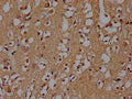 IHC image of CSB-PA021912OA01HU diluted at 1:100 and staining in paraffin-embedded human brain tissue performed on a Leica BondTM system. After dewaxing and hydration, antigen retrieval was mediated by high pressure in a citrate buffer (pH 6.0). Section was blocked with 10% normal goat serum 30min at RT. Then primary antibody (1% BSA) was incubated at 4°C overnight. The primary is detected by a biotinylated secondary antibody and visualized using an HRP conjugated SP system.