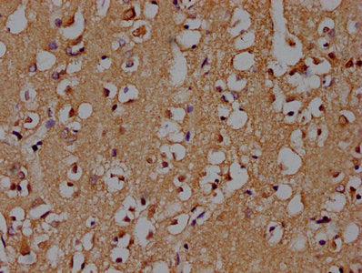 IHC image of CSB-PA021912OA01HU diluted at 1:100 and staining in paraffin-embedded human brain tissue performed on a Leica BondTM system. After dewaxing and hydration, antigen retrieval was mediated by high pressure in a citrate buffer (pH 6.0). Section was blocked with 10% normal goat serum 30min at RT. Then primary antibody (1% BSA) was incubated at 4°C overnight. The primary is detected by a biotinylated secondary antibody and visualized using an HRP conjugated SP system.