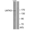 Western blot analysis of extracts from LOVO cells, using LMTK2 antibody.
