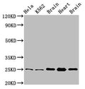 SOD2 Antibody, FITC conjugated – Figure 1 of 4
