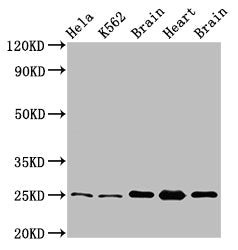 SOD2 Antibody, FITC conjugated – Figure 1 of 4