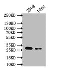Western Blot
Positive WB detected in: recombinant protein
All lanes: sodA Antibody at 1:1000
Secondary
Goat polyclonal to rabbit IgG at 1/50000 dilution
Predicted band size: 28 kDa
Observed band size: 28 kDa