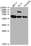 Western Blot
Positive WB detected in: MCF-7 whole cell lysate, PC-3 whole cell lysate, COLO320 whole cell lysate
All lanes: SRC antibody at 1:2000
Secondary
Goat polyclonal to rabbit IgG at 1/50000 dilution
Predicted band size: 60, 61 kDa
Observed band size: 60 kDa