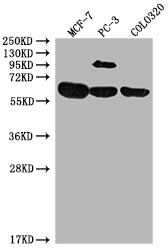 Western Blot
Positive WB detected in: MCF-7 whole cell lysate, PC-3 whole cell lysate, COLO320 whole cell lysate
All lanes: SRC antibody at 1:2000
Secondary
Goat polyclonal to rabbit IgG at 1/50000 dilution
Predicted band size: 60, 61 kDa
Observed band size: 60 kDa