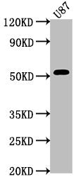 Western Blot
Positive WB detected in: U87 whole cell lysate
All lanes: SRPX antibody at 1:2000
Secondary
Goat polyclonal to rabbit IgG at 1/50000 dilution
Predicted band size: 52, 50, 46, 42  kDa
Observed band size: 52 kDa