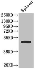 Western Blot Positive WB detected in: Mouse spleen tissue All lanes: SSTR2 antibody at 2.7ug/ml Secondary Goat polyclonal to rabbit IgG at 1/50000 dilution Predicted band size: 42, 41 kDa Observed band size: 42 kDa