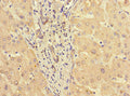 Immunohistochemistry of paraffin-embedded human liver tissue using CSB-PA022812LA01HU at dilution of 1:100