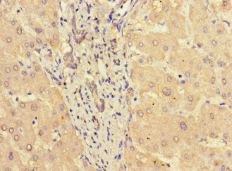 Immunohistochemistry of paraffin-embedded human liver tissue using CSB-PA022812LA01HU at dilution of 1:100