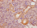 IHC image of CSB-PA022817LA01HU diluted at 1:100 and staining in paraffin-embedded human salivary gland tissue performed on a Leica BondTM system. After dewaxing and hydration, antigen retrieval was mediated by high pressure in a citrate buffer (pH 6.0). Section was blocked with 10% normal goat serum 30min at RT. Then primary antibody (1% BSA) was incubated at 4°C overnight. The primary is detected by a Goat anti-rabbit polymer IgG labeled by HRP and visualized using 0.05% DAB.