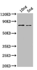 Western Blot
Positive WB detected in: recombinant protein
All lanes: SPT16 Antibody at 1:1000
Secondary
Goat polyclonal to rabbit IgG at 1/50000 dilution
Predicted band size: 65 kDa
Observed band size: 65 kDa
