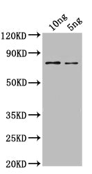 Western Blot
Positive WB detected in: recombinant protein
All lanes: SPT16 Antibody at 1:1000
Secondary
Goat polyclonal to rabbit IgG at 1/50000 dilution
Predicted band size: 65 kDa
Observed band size: 65 kDa