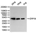 Western Blot
Positive WB detected in: recombinant protein
All lanes:ZYP1B Antibody at 1:1000
Secondary
Goat polyclonal to rabbit IgG at 1/20000 dilution
Predicted band size: 37.5 kDa
Observed band size: 37.5 kDa