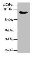 Western blot
All lanes: SYN1 antibody at 12µg/ml + Mouse brain tissue
Secondary
Goat polyclonal to rabbit IgG at 1/10000 dilution
Predicted band size: 75, 71 kDa
Observed band size: 75 kDa