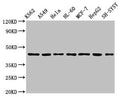 Western Blot
Positive WB detected in: K562 whole cell lysate, A549 whole cell lysate, Hela whole cell lysate, HL60 whole cell lyasate, MCF-7 whole cell lysate, HepG2 whole cell lysate, SH-SY5Y whole cell lysate
All lanes: TARDBP antibody at 2.5µg/ml
Secondary
Goat polyclonal to rabbit IgG at 1/50000 dilution
Predicted band size: 45, 32 kDa
Observed band size: 45 kDa