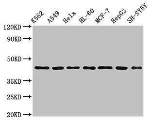 Western Blot
Positive WB detected in: K562 whole cell lysate, A549 whole cell lysate, Hela whole cell lysate, HL60 whole cell lyasate, MCF-7 whole cell lysate, HepG2 whole cell lysate, SH-SY5Y whole cell lysate
All lanes: TARDBP antibody at 2.5µg/ml
Secondary
Goat polyclonal to rabbit IgG at 1/50000 dilution
Predicted band size: 45, 32 kDa
Observed band size: 45 kDa