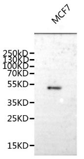 Western Blot
Positive WB detected in: MCF-7 whole cell lysate
All lanes: SPCS3 antibody at 1:1000
Secondary
Goat polyclonal to rabbit IgG at 1/50000 dilution
Predicted band size: 51 kDa
Observed band size: 51kDa