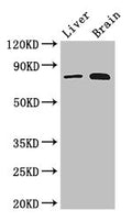 Western Blot Positive WB detected in: Mouse liver tissue, Mouse brain tissue All lanes: TBK1 antibody at 3ug/ml Secondary Goat polyclonal to rabbit IgG at 1/50000 dilution Predicted band size: 84 kDa Observed band size: 84 kDa