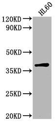 Western Blot
Positive WB detected in: HL60 whole cell lysate
All lanes: TCF19 antibody at 1:2000
Secondary
Goat polyclonal to rabbit IgG at 1/50000 dilution
Predicted band size: 38 kDa
Observed band size: 38 kDa