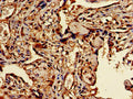 TFEB Antibody – Figure 1 of 3